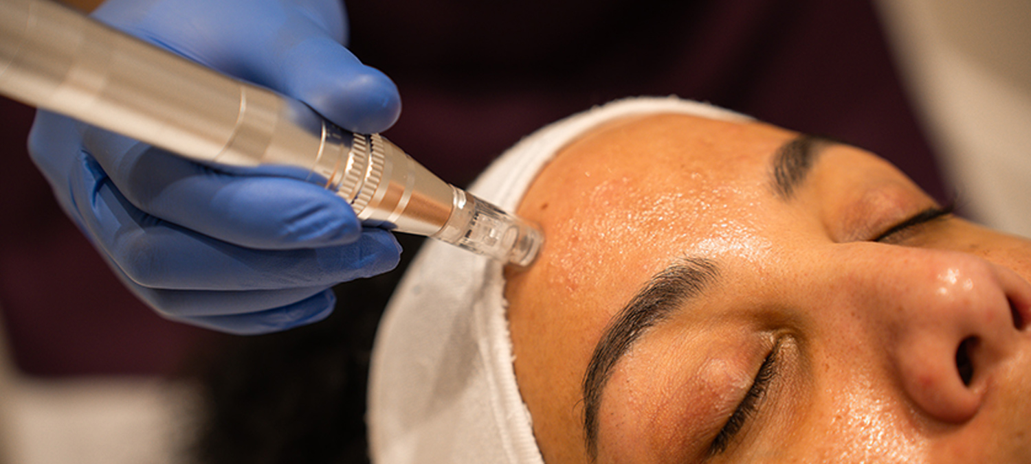 Collagen Induction Therapy & Facial Needling