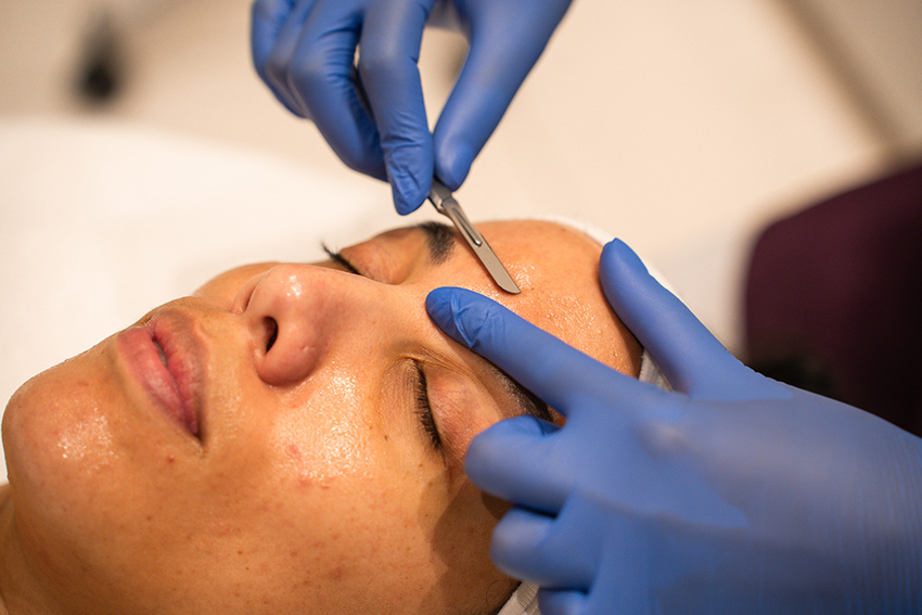 Dante Wellness Dermaplaning Seapoint Cape Town